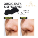 Blackhead Remover Nose Strips – Pore Cleansing & Deep Cleaning Patches - Image 3