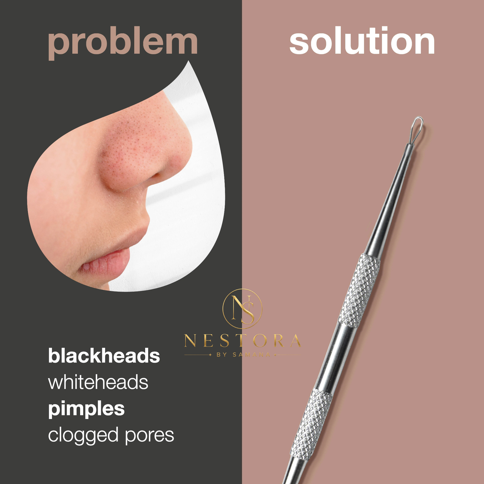 Untitled design (70) Blackhead Remover Tool – Comedone & Pimple Extraction Tool - Image 1